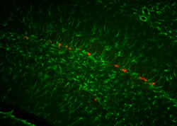 Neurogenesis in adult hippocampus