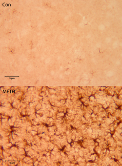 Histology image of striatal astrocytes
