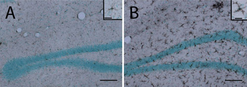 IBA-1 stained microglia