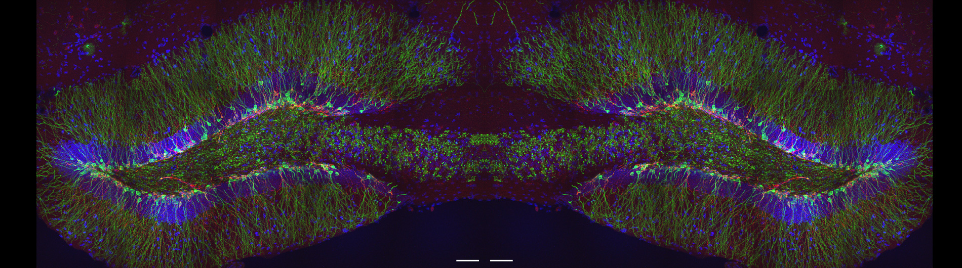 brain cell histology
