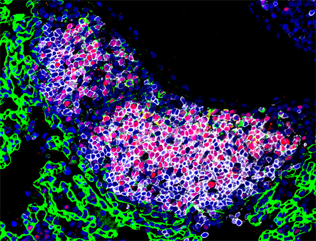 Germinal center in the lung of mice infected with Pneumocystis murina. PCNA in red, PNA in green and B220 in white.