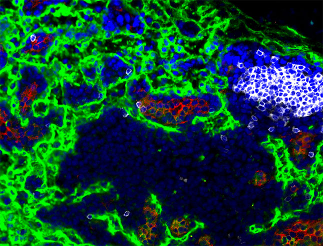Immunofluorescence of lymph node after exposure to neonatal irradiation. PNAd in red, Lyve 1 in green and B220 in white.