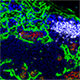 Immunofluorescence of lymph node after exposure to neonatal irradiation