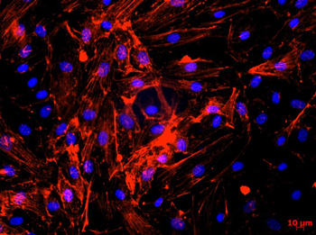 Human coronary artery endothelial cells stained for CD31