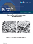 Featured on the cover of Journal of Orthopaedic Research, September 2015