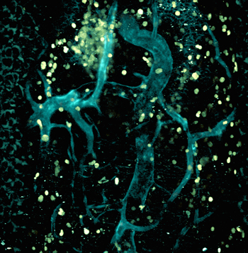 Image of an influenza infected trachea obtained by multiphoton microscopy