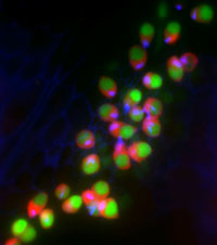 In vitro differentiated hair cells
