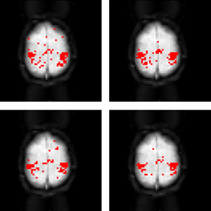 Functional Connectivity Analysis in the Human Brain Using Resting State fMRI Data