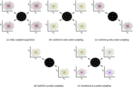 Illustration of various HARDI acquisition schemes using a multishot spiral k-space
                trajectory. e: The proposed incoherent k-q under-sampling scheme jointly and incoherently under-samples the
                combined k-q space. Here, each q-space point is sampled at different k-space locations using random k-space
                shots. Only four shots are used here; however, instead of using the same four shots for all q-space points, they
                are sampled using different shots.