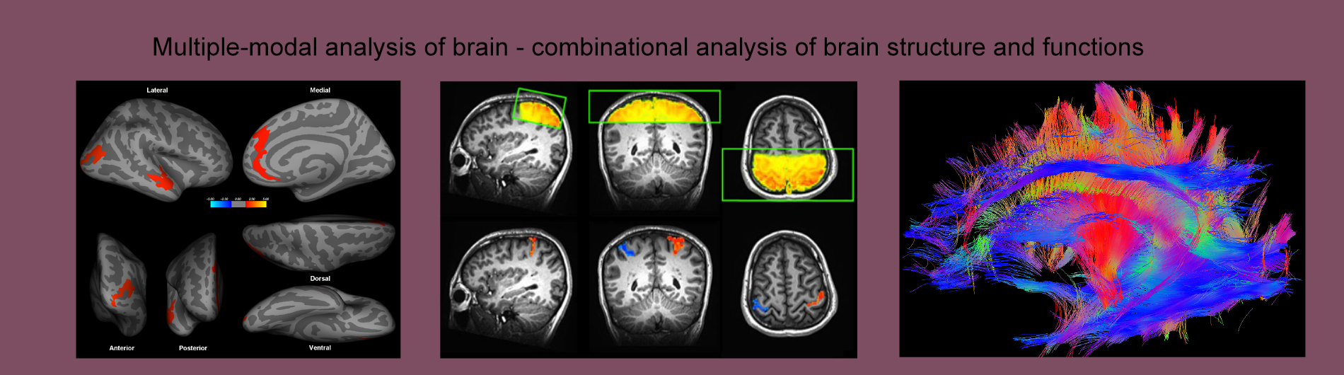 Zhong lab research photo 2