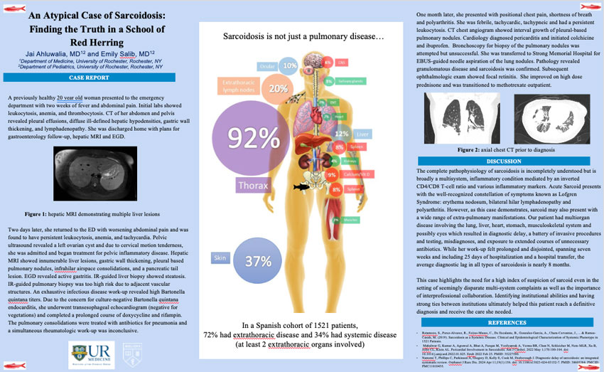 Screen capture of Dr. Ahluwalia's poster