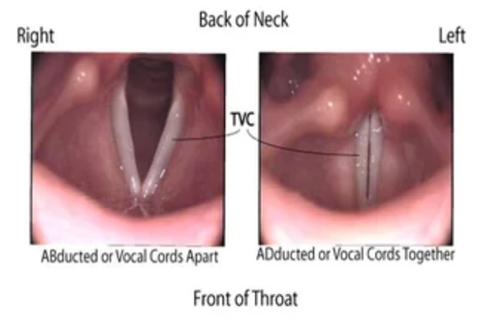 Two images of vocal cords on laryngoscopy. Image on left shows ABducted or vocal cords apart. Image on right shows ADducted or vocal cords together.