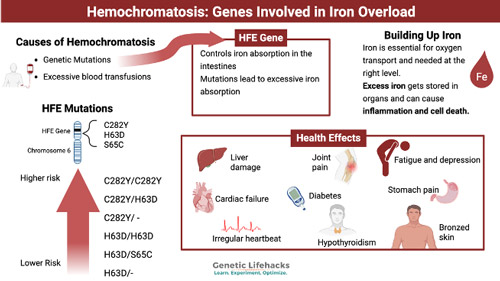Figure 1: HFE dysfunction leads to inappropriately low hepcidin activity and increased intestinal absorption, resulting in progressive systemic iron accumulation. Cardiac iron deposition promotes oxidative injury and myocardial dysfunction, which can progress to dilated cardiomyopathy, arrhythmias, and heart failure.