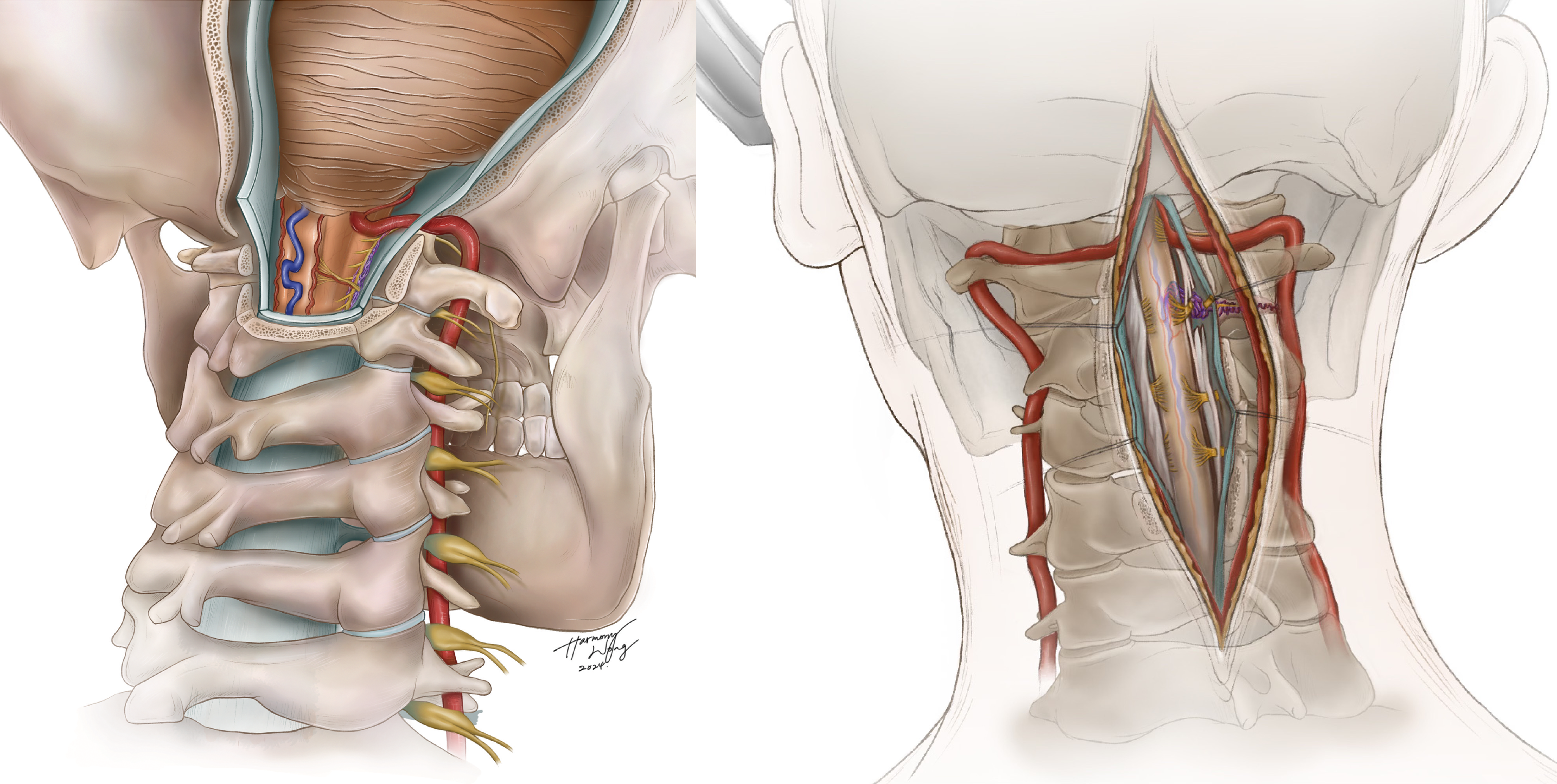 Illustration C