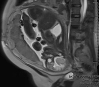 Fetal MRI image