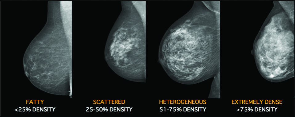 Breast Density Categories