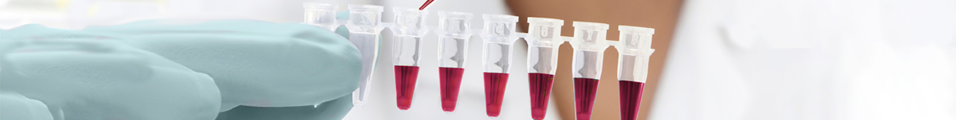 Sample tubes being filled by a pipette