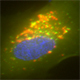 Mechanisms of Lung Vascular Autophagy and Inflammation