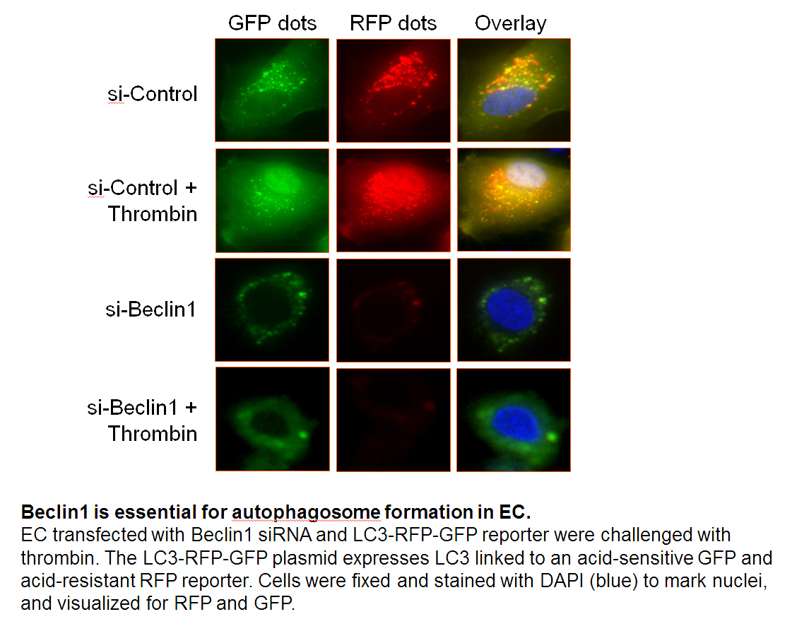 Beclin1 is essential for autophagosome formation in EC