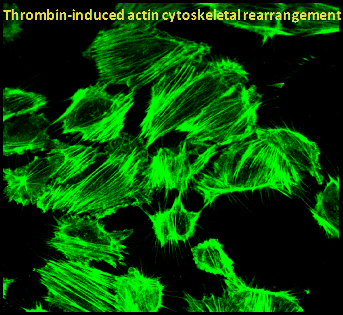 Thrombin-induced Actin Cytoskeletal Rearrangement