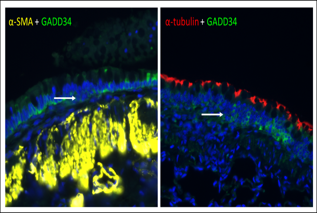Immunoflourescent images of rat airways with airway remodeling marked by alpha-smooth muscle actin (α-SMA; yellow), integrated stress response protein GADD34 (green), and ciliated cells with alpha (α)-tubulin (red)