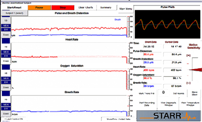 Real-time monitoring of animal vital signs (heart rate, oxygen saturations) using STARR Life Science software and sensors