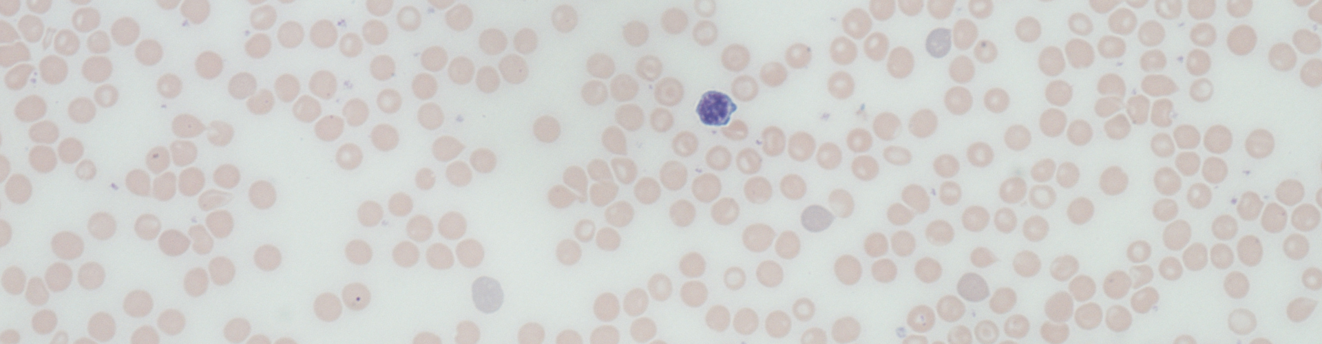 blood smear