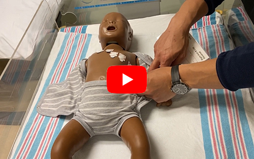 ECG lead placement on an infant
