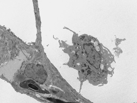 Sequential magnification of lung macrophage (lower right in image)