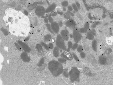 High magnification of lysosomes containing 20nm gold particles
