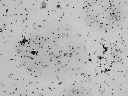 TEM image of 20nm gold particles