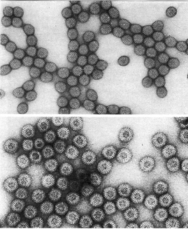 Negative stain of rotavirus