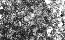 Electron micrograph of smooth  endoplasmic reticulum