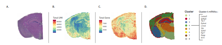 H&E and gene clustering image of mouse brain using spatial transcriptomics from 10X Genomics