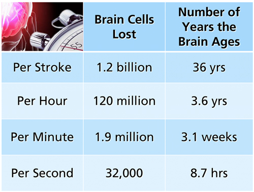 Time Is Brain
