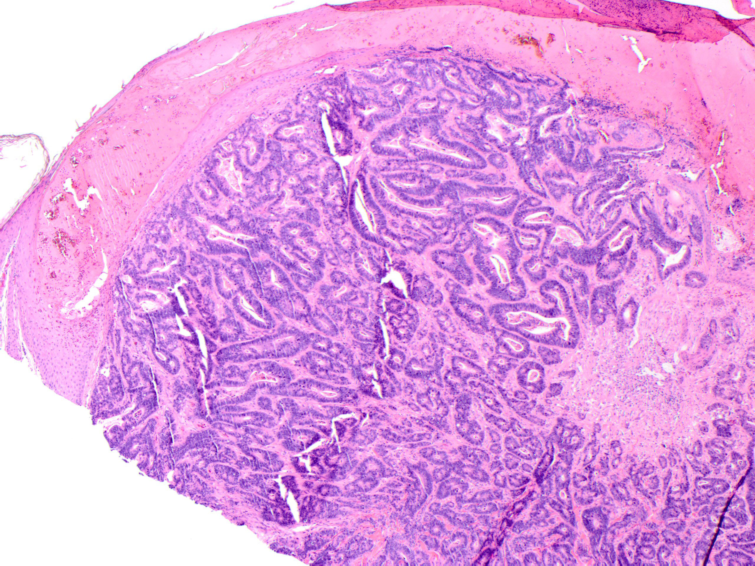 Figure 2: Cutaneous lesion biopsy, 40x magnification.