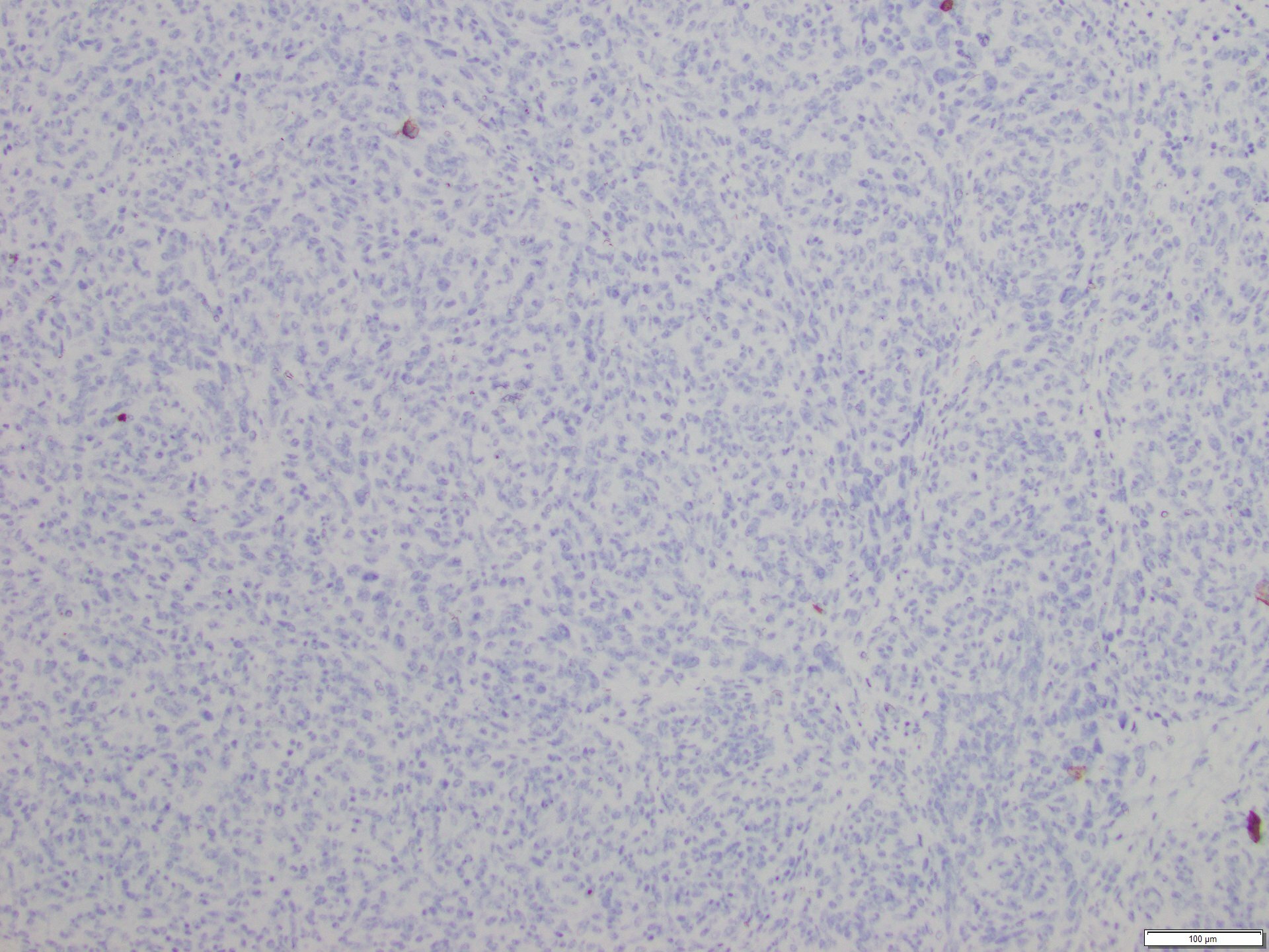 Figure 6. Negative pan-cytokeratinimmunohistochemical staining.