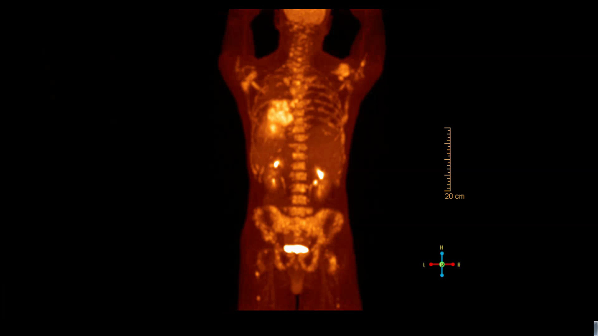 Figure 6: Positron emission tomography (PET) scan.