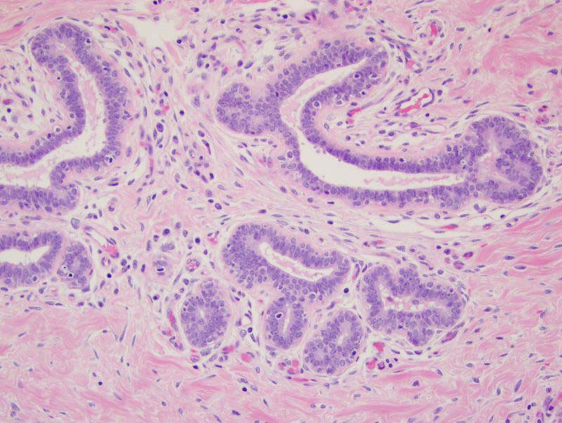 The epithelium consists of luminal and myoepithelial cells without atypia or hyperplasia.