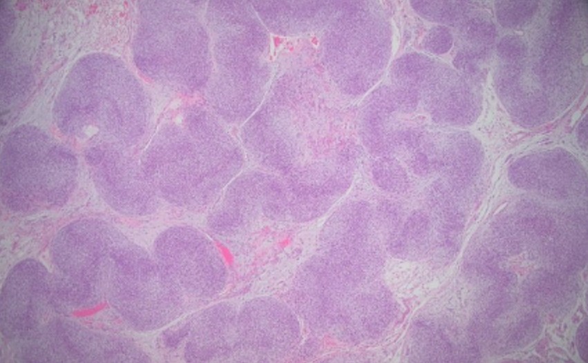 figure 3 H&E