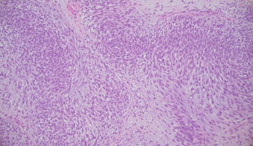figure 4 H&E
