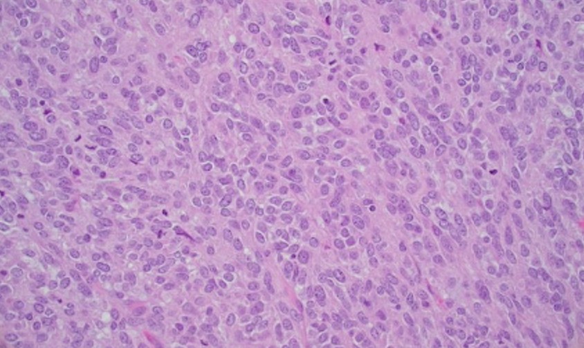 figure 5 H&E