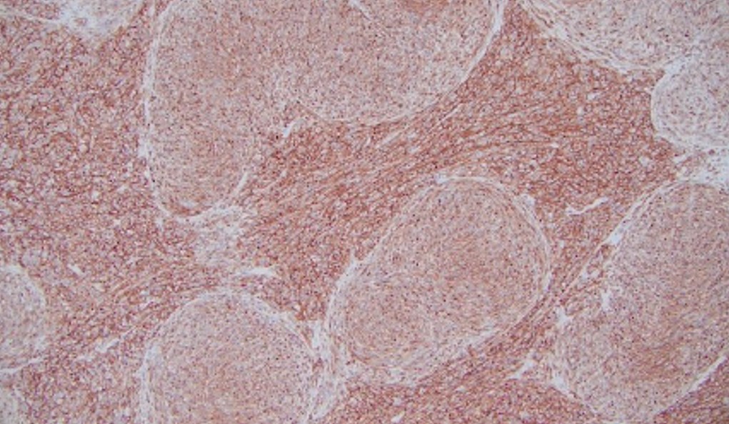 figure 7 c-KIT