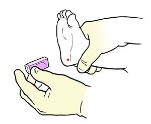 Closeup of gloved hands removing lancet from baby's heel after heelstick.