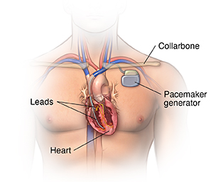 Content - Health Encyclopedia - University of Rochester Medical Center