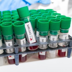 Use the COVID-19 Biobank to Support Your Coronavirus Research