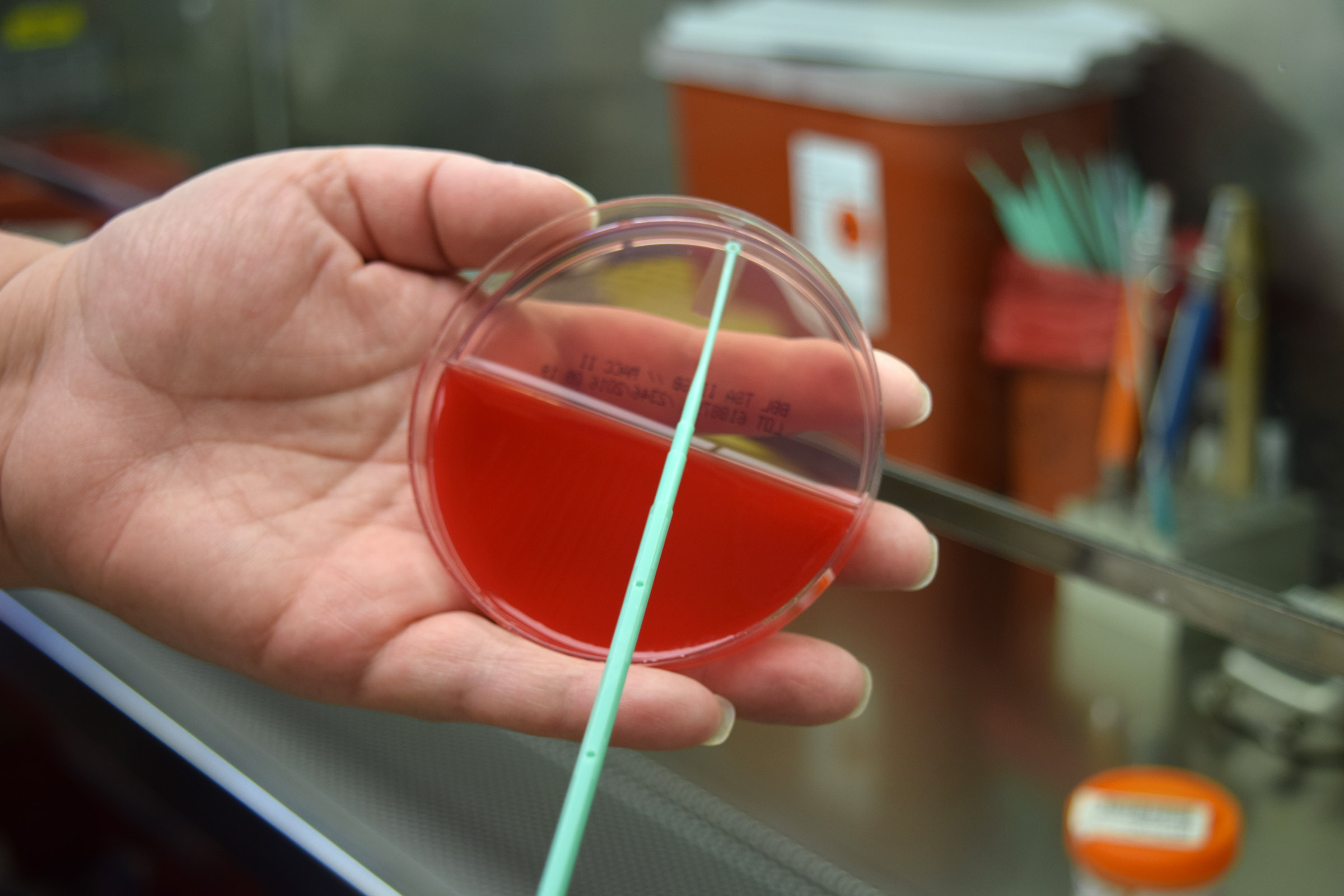 A Look Inside the Bacteriology Lab: What Does Your Culture Grow? 
