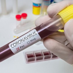 COVID-19 Biobank Helps Researchers Share Patients’ Samples