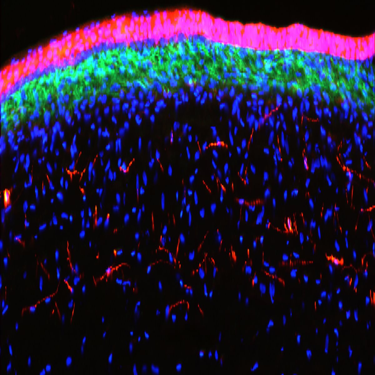 Huxlin, MacRae and URMC colleagues discover a new approach to treat established corneal fibrosis