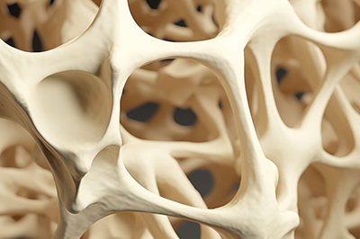 Bone Density Scans (DEXA): What They Show About Your Osteoporosis Risk